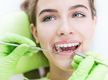 composite dental fillings